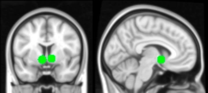 The nucleus accumbens, highlighted in green, is the "hub of the brain's reward circuitry." It lit up when teens saw their own photos or "likes."