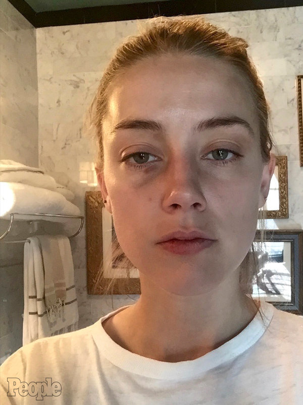 New Photos Supporting Amber Heard’s Abuse Allegations Against Johnny ...