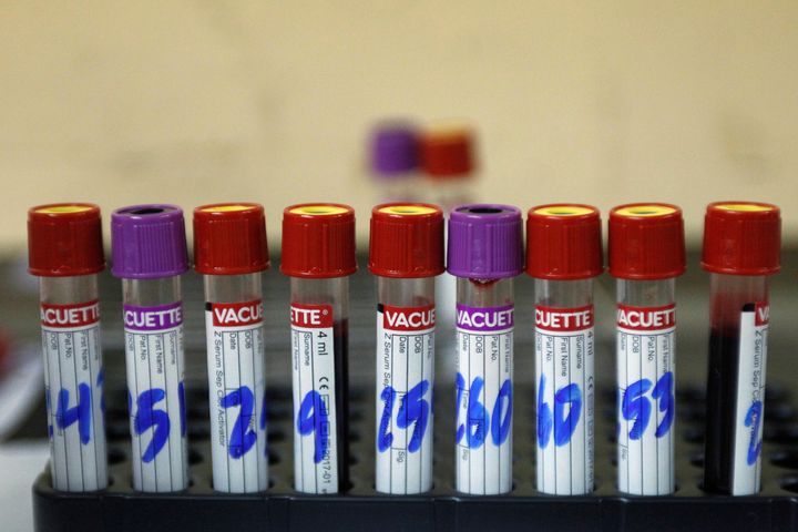 Test tubes with blood samples from patients who have been tested for Zika at the maternity ward of the Hospital Escuela in Tegucigalpa, Honduras, on April 15, 2016.