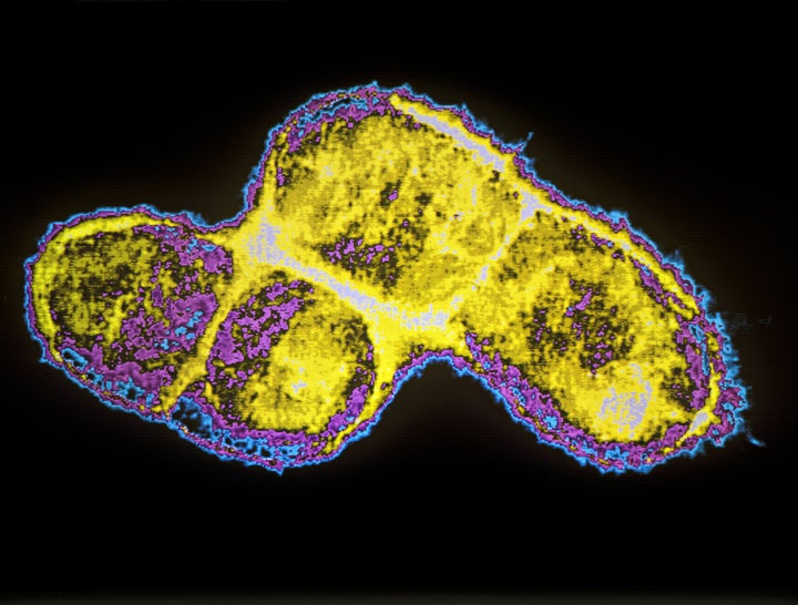 The discovery of bacteria that is resistant to our "last resort" antibiotic means we need new antibiotics, now. Pictured: E. coli bacteria. 