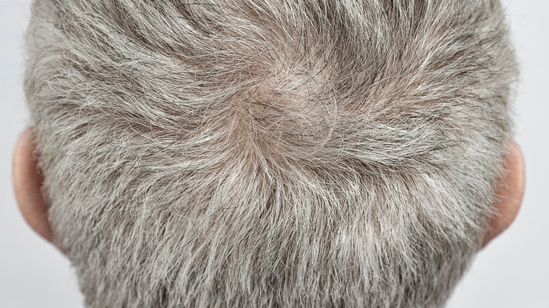 Getting grey. Седые волосы сзади. Сальные волосы с сединой. Голова мужской с седыми волосами вид сзади. Борьба с сединой у мужчин.