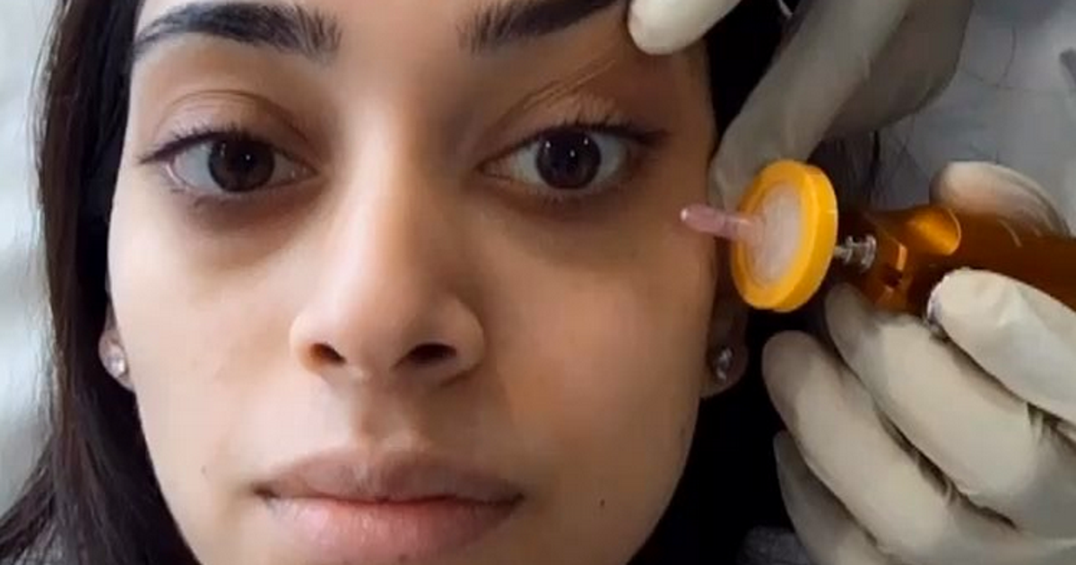 Carboxy Therapy Claims To Get Rid Of Dark Circles With