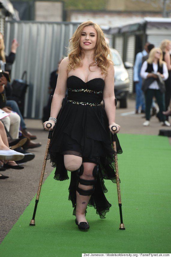 Vicky Balch, who appeared on the runway for the Models of Diversity catwalk show in London in October 
