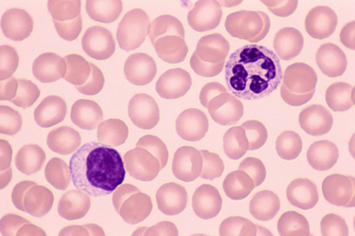 Lymphocyte & neutrophil; white blood cells (leukocytes), 400X at 35mm.
