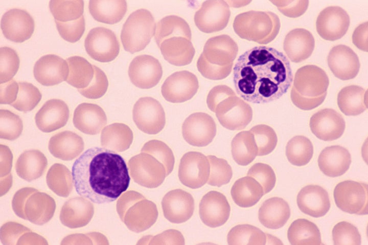 Lymphocyte & neutrophil; white blood cells (leukocytes), 400X at 35mm.