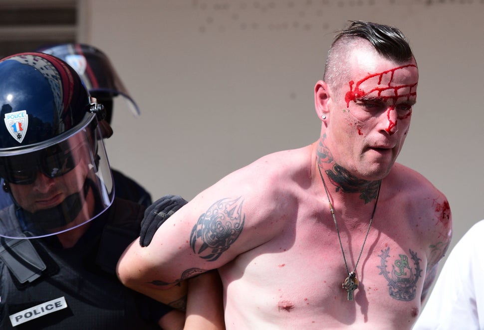An injured England fan is detained by police personnel as England fans gather in the city of Marseille, southern France, on J