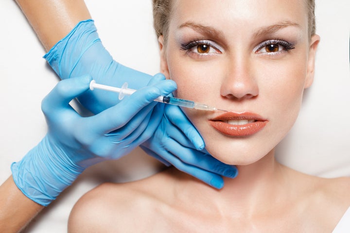 Fillers are on the rise, thanks to Kylie.