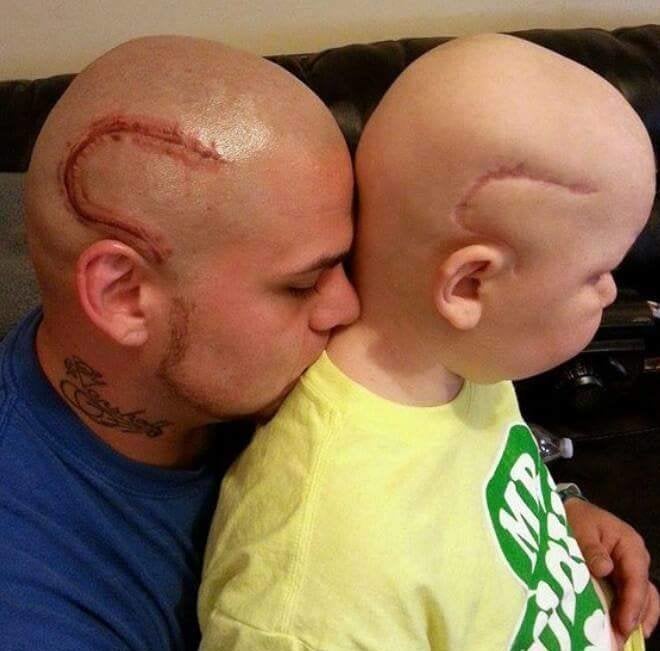 Best Dad Ever Gets Son's Scar From Cancer Tattooed In Same Place