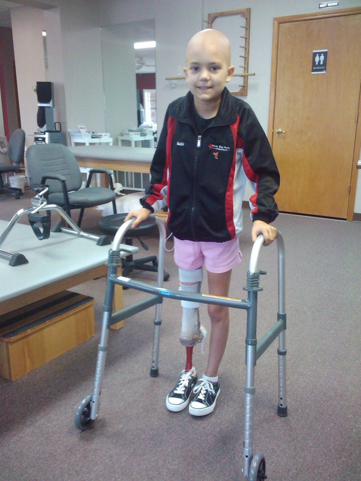 Gabi shortly after having an amputation.