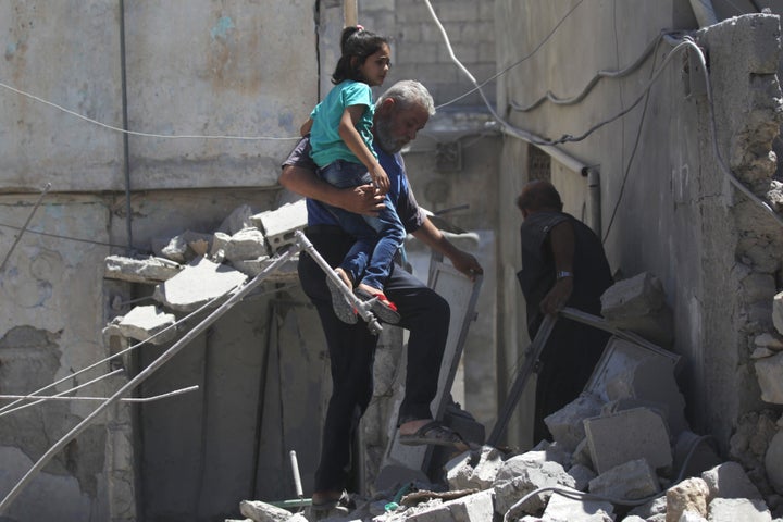 As Syrian and Russian airstrikes hit towns in rebel-controlled areas, children suffer injuries, loss and sometimes, death. Ov