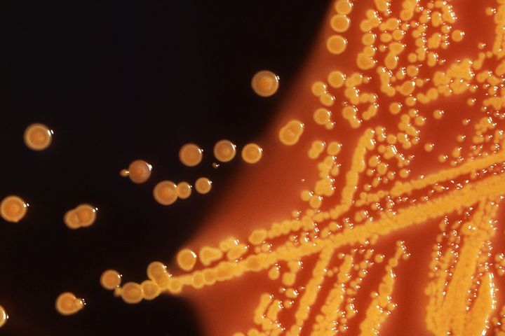Colonies of E. coli bacteria are seen. In May, U.S. health officials reported the first case in the country of a patient with E. coli bacteria carrying the mcr-1 gene.