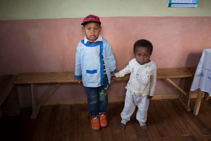Miranto (left) and Sitraka were born on the same day in the same Madagascar village, but Sitraka is chronically malnourished.