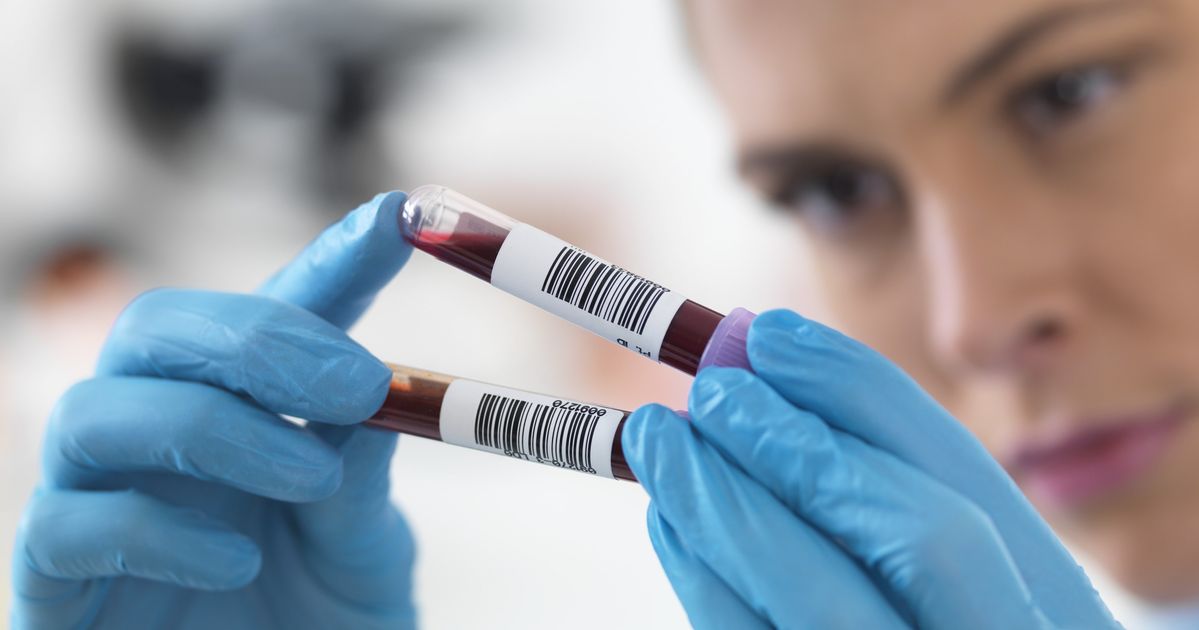 Your Blood Type Is 'Best Indicator' Of Your Risk Of Heart Disease ...