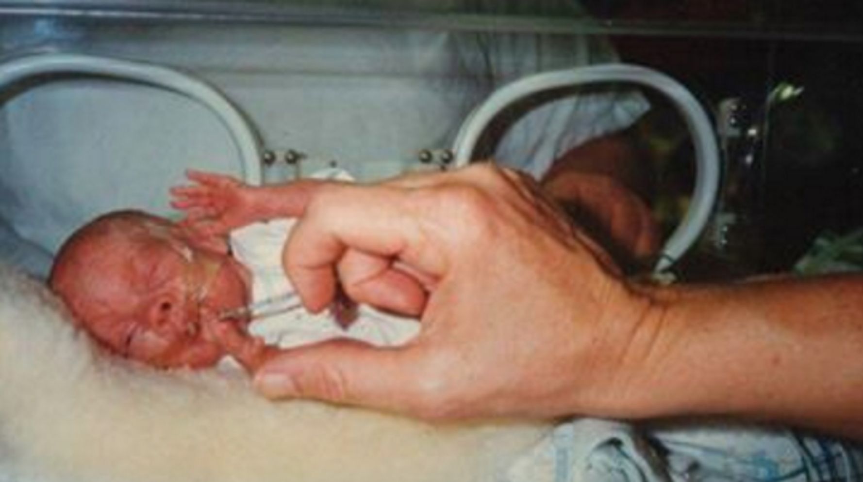 babies born at 15 weeks