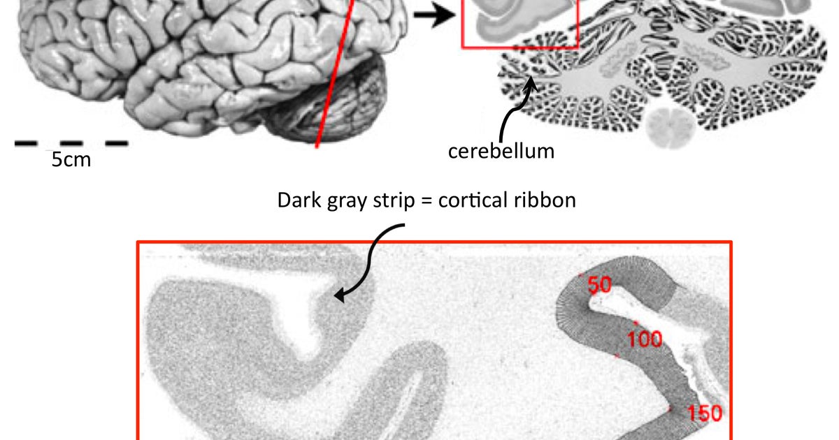 Let's take a walk along the cortical ribbon | HuffPost Contributor