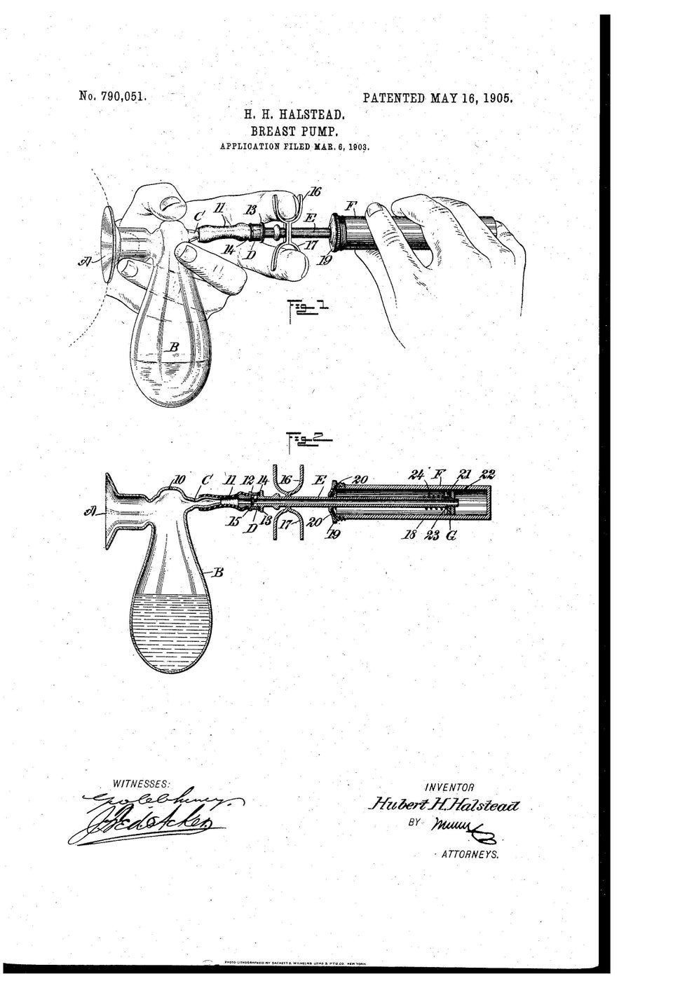 A History of the Breast Pump, Innovation