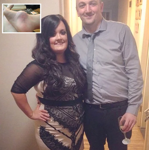 Cancer Survivor Hid Golf Ball-Sized Lump From Boyfriend For 2 Years, But  Showing Him Saved Her Life | HuffPost UK Life
