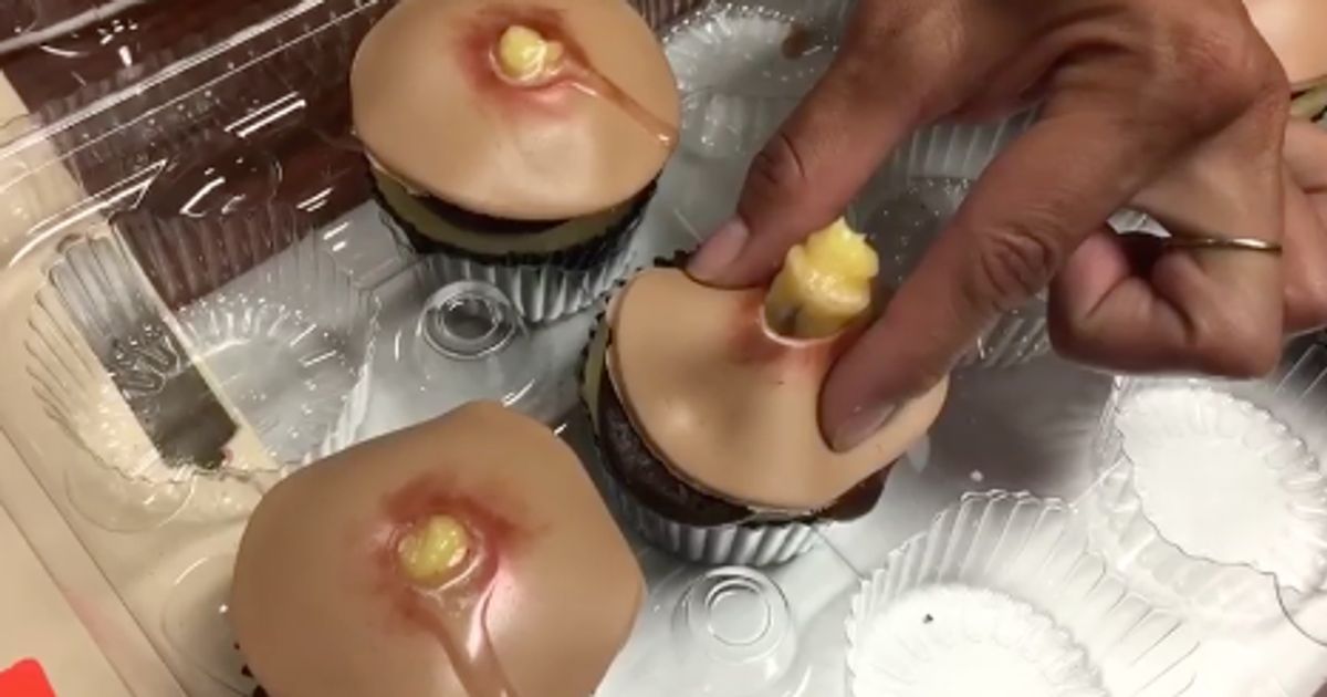 schroot uitbreiden Aarzelen It's Hard To Resist Popping These Disgusting Pimple Cupcakes | HuffPost  Weird News