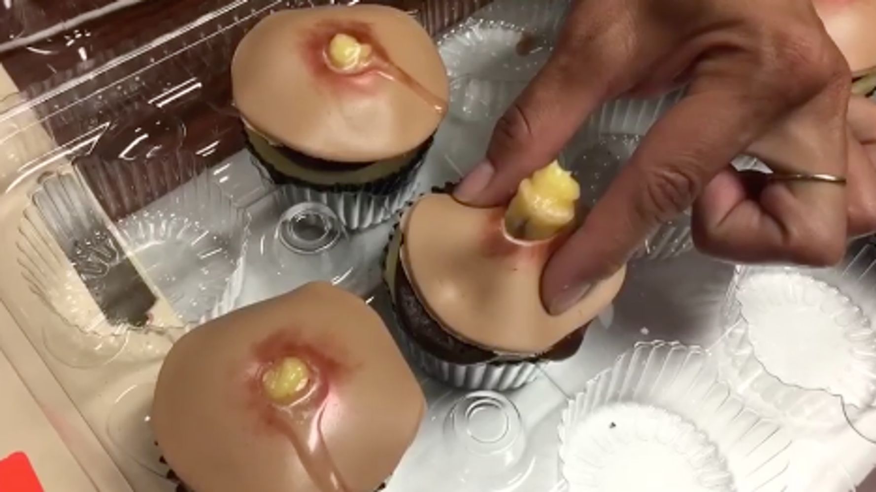 Omgaan met Ecologie slinger It's Hard To Resist Popping These Disgusting Pimple Cupcakes | HuffPost  Weird News