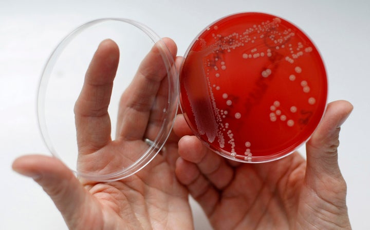 A petri dish containing MRSA. 