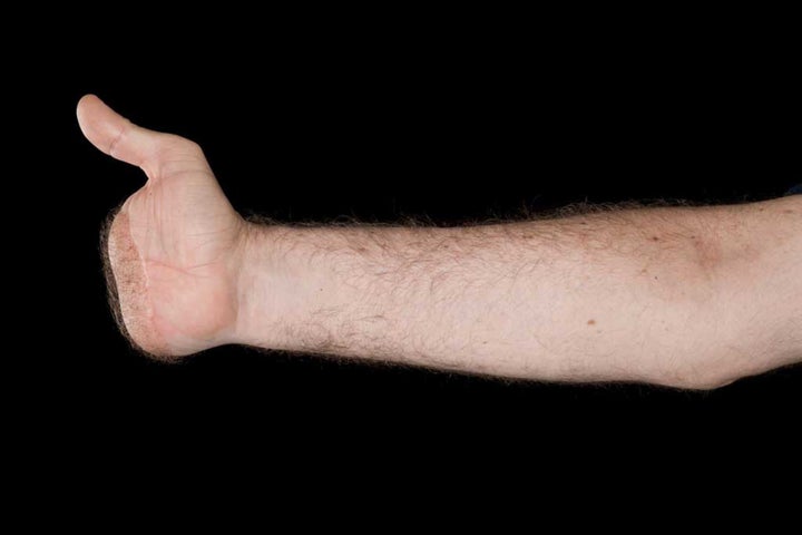 <strong>Before picture of King's right hand and left, below </strong>