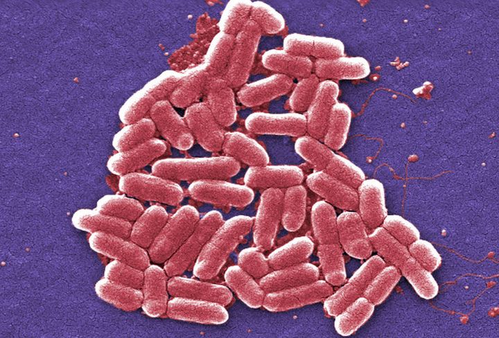 E. coli bacteria strain