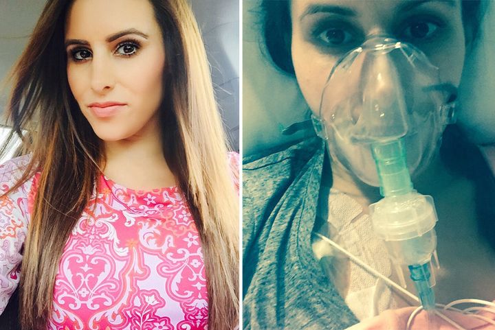 Jessica DeCristofaro before her diagnosis and after when she was hospitalised.