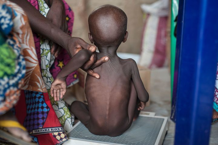 A young girl at the Muna settlement for displaced people. UNICEF estimates that some 50,000 children in northeast Nigeria are at risk of dying from malnutrition and related causes without immediate assistance.