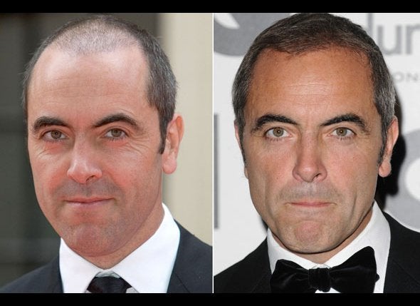 James Nesbitt