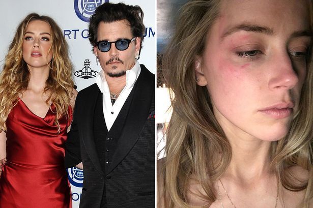 Heard claims that Depp abused her for years during their marriage. 
