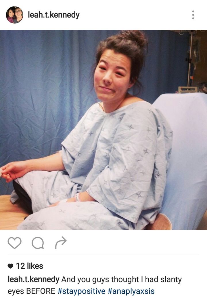 I uploaded this to my Instagram Nov. 5th 2014 -- My last hospital visit for anaphylactic shock. SO thankful for doctors and modern medicine. Those gowns are embarrassing enough as it is.