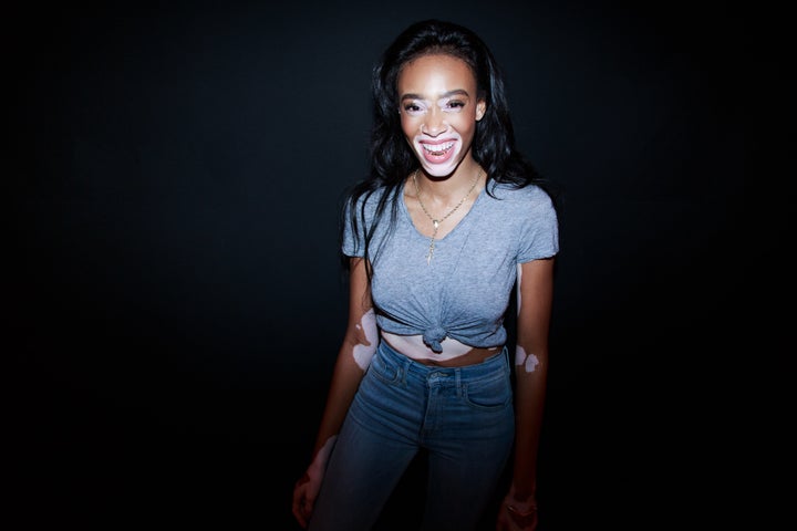 Winnie Harlow