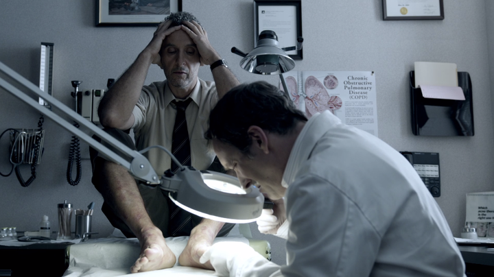 John Turturro as John Stone in "The Night Of." He visits a dermatologist to get help for his eczema. 