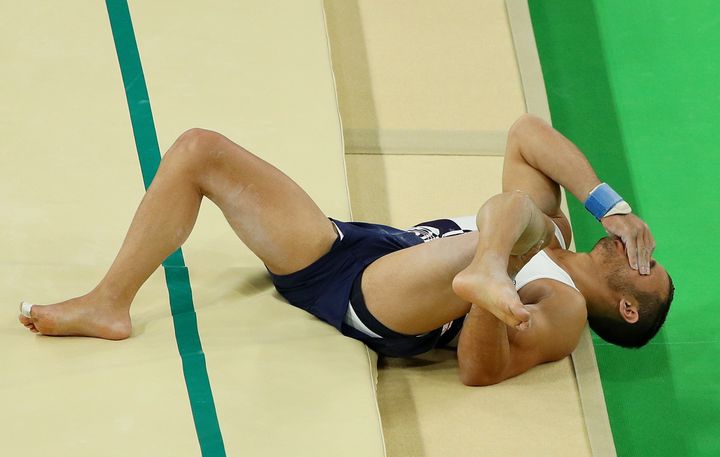 The break can be clearly seen as the gymnast's leg can be seen hanging at an awkward angle