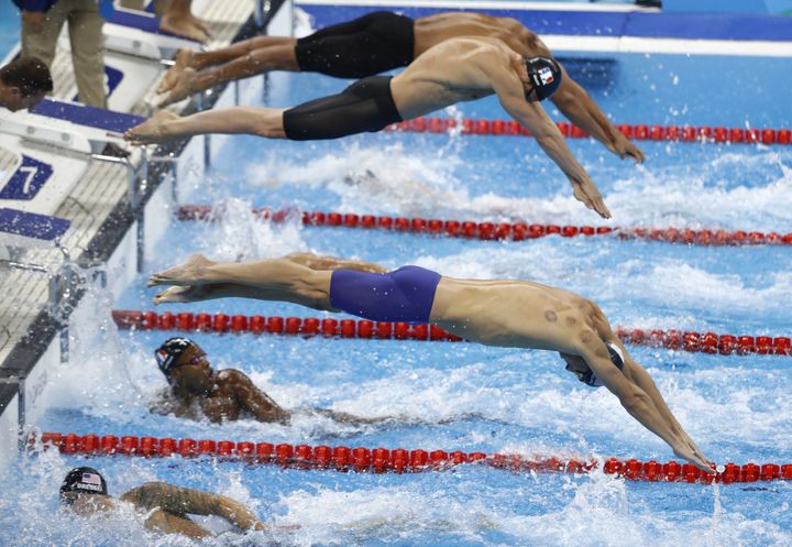 Michael Phelps, shown on the second leg of Team USA's victorious 4X100 meter relay, receives cupping treatments.