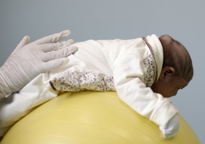 A physiotherapist works with 19-day-old Sophia, who was born with microcephaly, at Pedro l Hospital in Campina Grande, Brazil on February 18, 2016. 