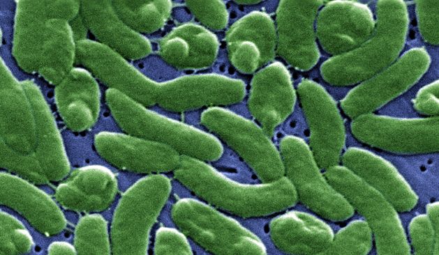 There are about 110 different types of Vibrio bacteria living in our oceans, according to Carbon Brief. The most well-known of them is cholera, a potentially deadly diarrheal disease.