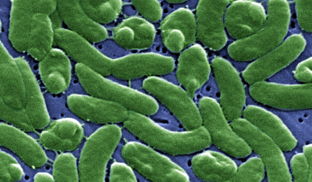 There are about 110 different types of Vibrio bacteria living in our oceans, according to Carbon Brief. The most well-known of them is cholera, a potentially deadly diarrheal disease.