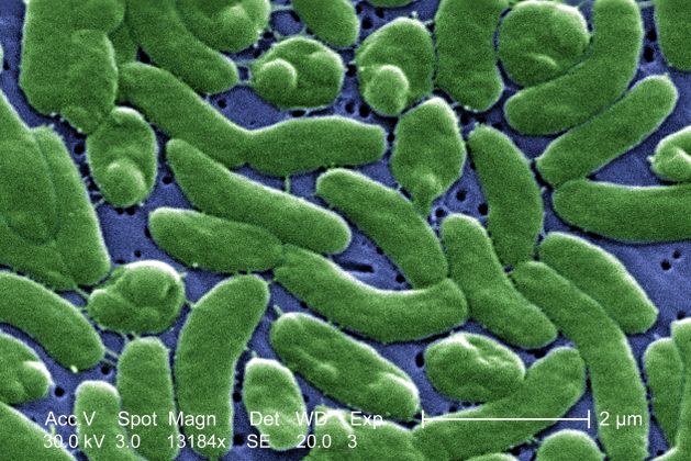 There are about 110 different types of Vibrio bacteria living in our oceans, according to Carbon Brief. The most well-known of them is cholera, a potentially deadly diarrheal disease.