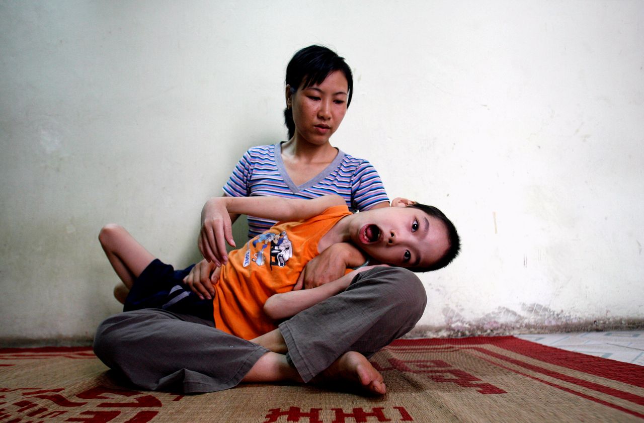 Ten-year-old Pham Duc Duy is cradled in the arms of his mother, Nguyen Thi Thanh Van, 35, in their house in Hanoi June 16, 2007. Vietnamese doctors believe Duy, whose grandfather served in the Vietnam war, is a victim of exposure to dioxin passed down the generations. 
