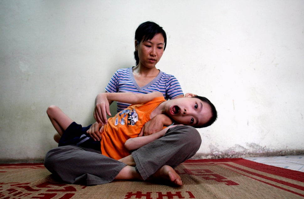 Ten-year-old Pham Duc Duy is cradled in the arms of his mother, Nguyen Thi Thanh Van, 35, in their house in Hanoi June 16, 20