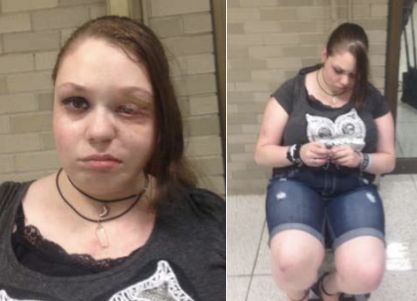 Cohen is seen after her arrest. Police said that she suffered a small cut to her eye from the scuffle and appeared to have suffered a stroke at one time.