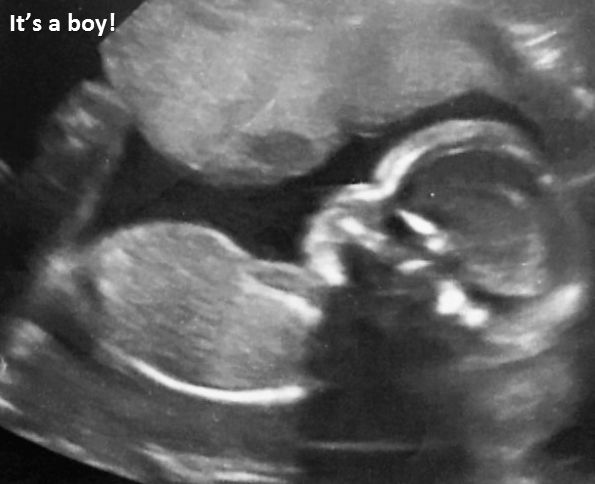 My Ultrasound. I am expecting a baby boy September 14, 2016