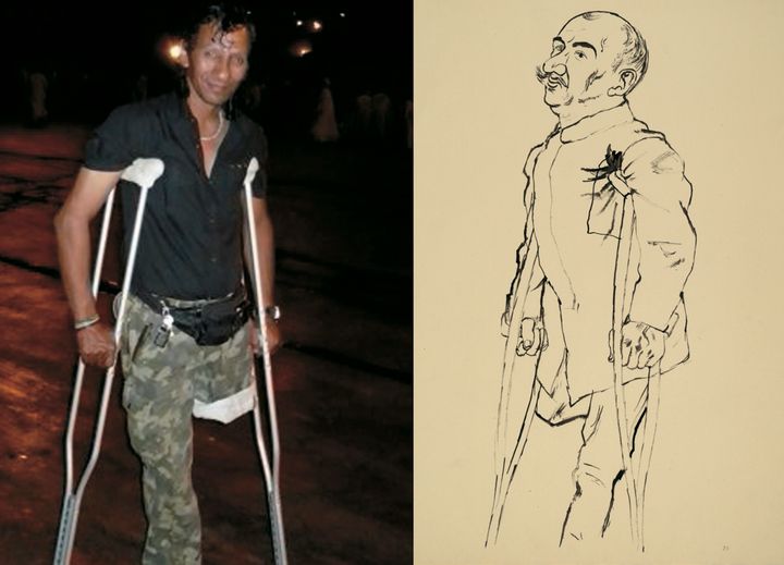 Hussein © Hugh BerginWar Cripple © Estate of George GroszCourtesy Akim Monet Side by Side Gallery, Berlin