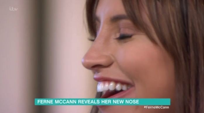 Ferne has had her nose reshaped