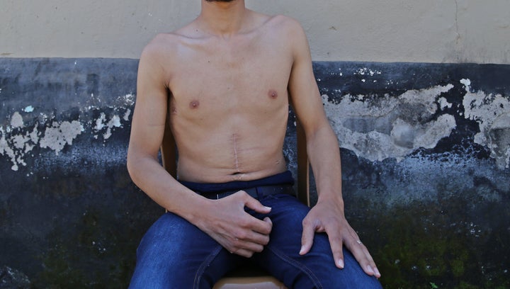 Hasan Ahmed, who was imprisoned for six months in Hama, Syria, then fled to Turkey. 