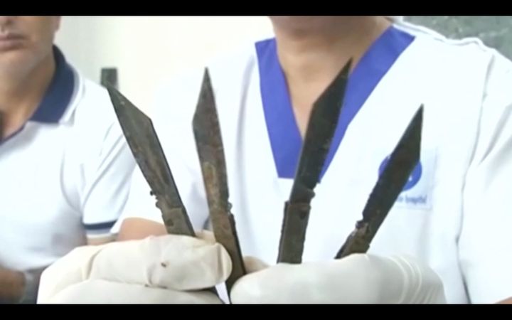 A doctor holds up four knives that are said to have been removed from a man's stomach in northern India.