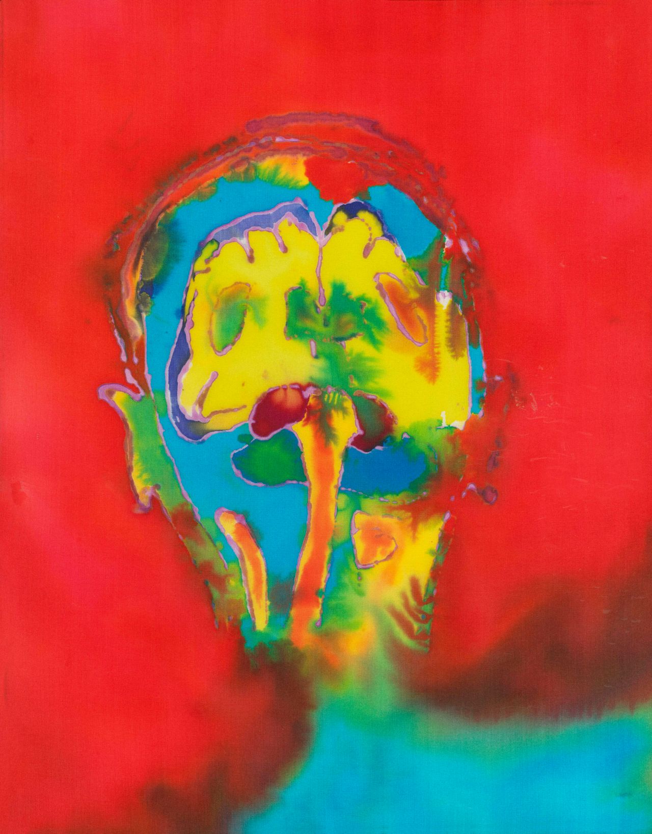 "Self Portrait of the Artist's Brain 2," a sagittal MRI view of the artist's brain.