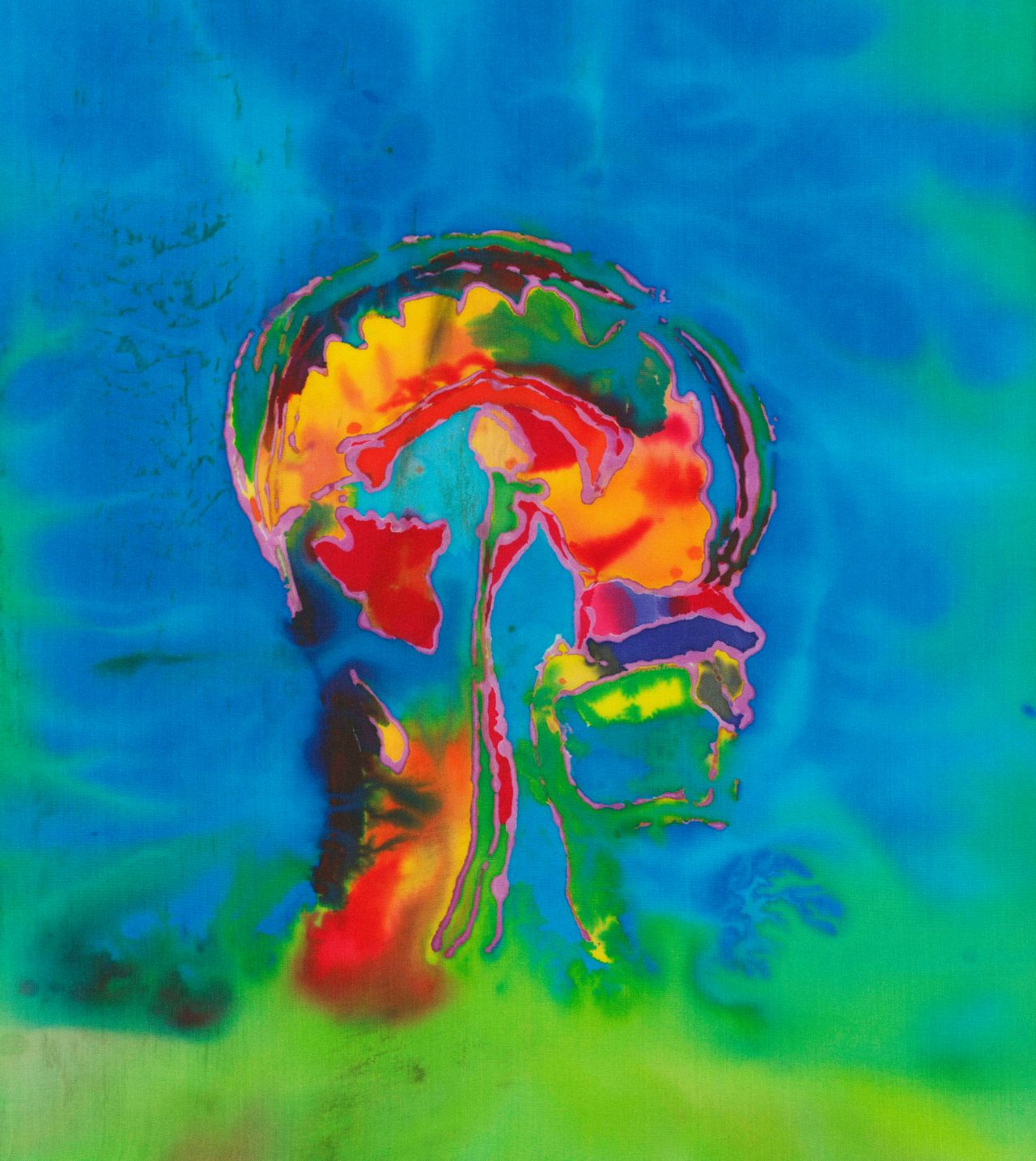 "Self Portrait of the Artist's Brain 1," a sagittal MRI view of the artist's brain.