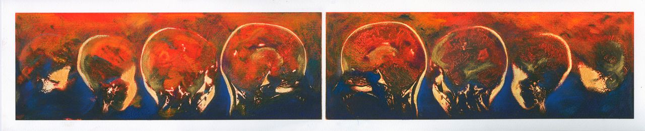 "Transformations and Turnarounds," sagittal views of the artist's brain.